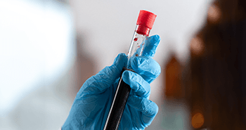 Ręka laboranta trzymająca probówki