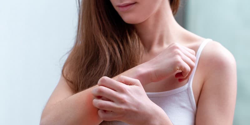 genetyczne choroby skóry - zdjęcie przedstawia kobietę, która odczuwa swędzenie przedramienia