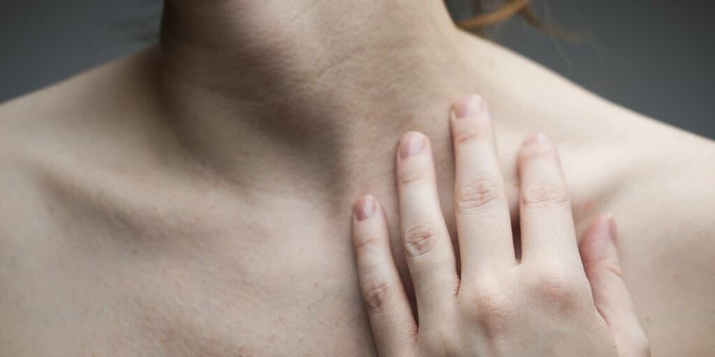 Koilonychia - zdjęcie dłoni ułożonej na obojczyku