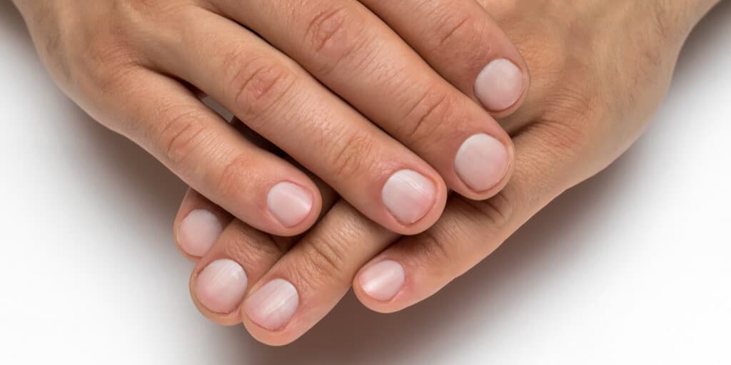 bruzdy na paznokciach