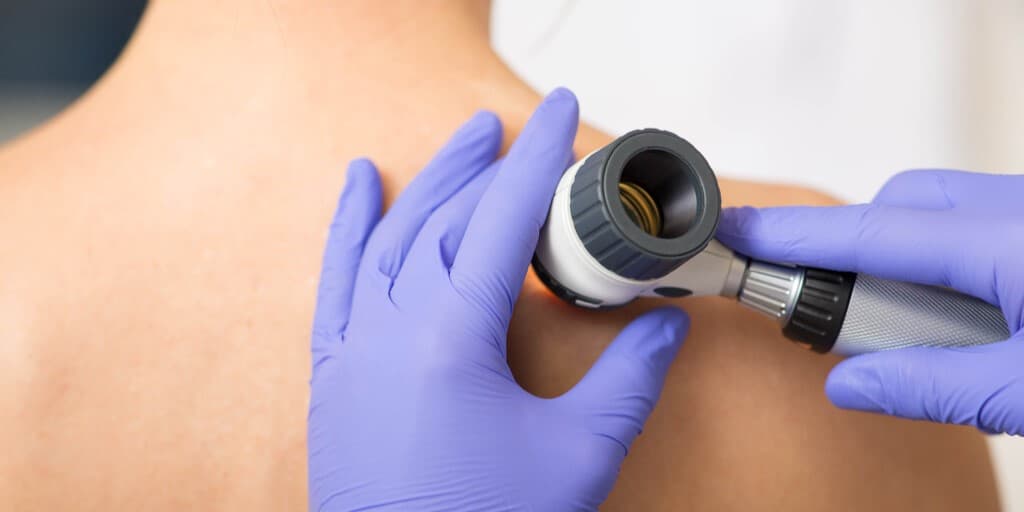 skóra na plecak dziecka badania przez lekarza, ponieważ ma ono białe plamy na skórze