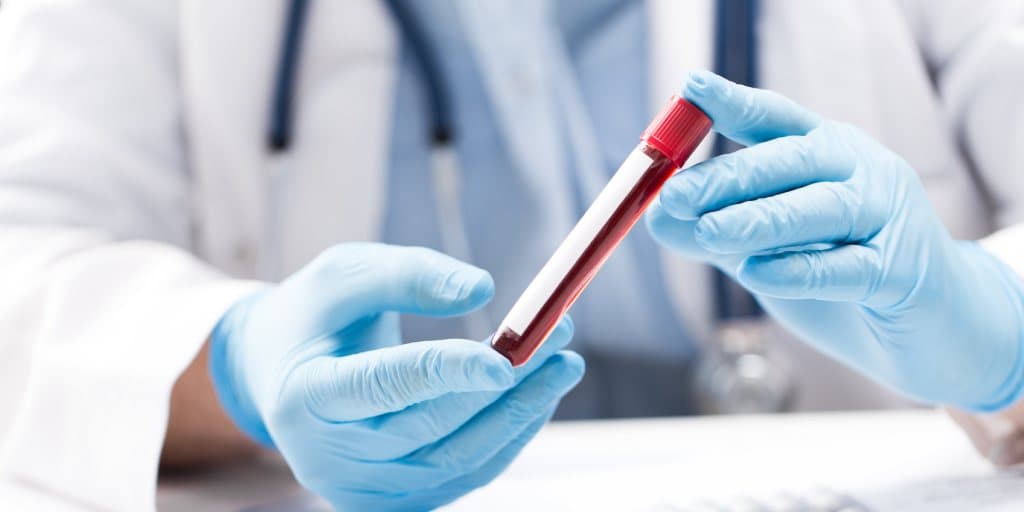 agregacja płytek krwi