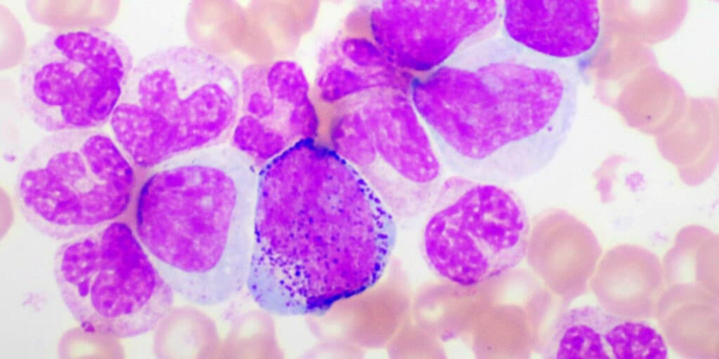 Monocytoza - zdjęcie mikroskopowe