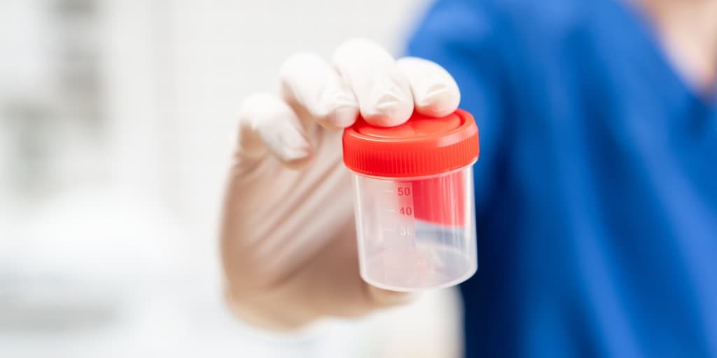 Testy na obecność narkotyków - zdjęcie przedstawia pojemnik na mocz