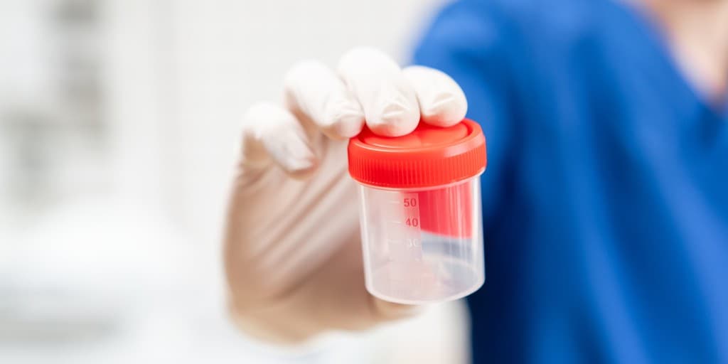 Fosforany bezpostaciowe w moczu